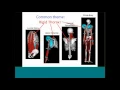 Webinar Meet Me in the Middle - A Thoracolumbar Spine and Rib Cage Model in OpenSim
