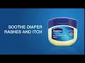 Vaseline Hacks - Healing Diaper Rash