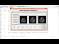 Image Fusion using Curvelet DWT and Contourlet DWT MATLAB code