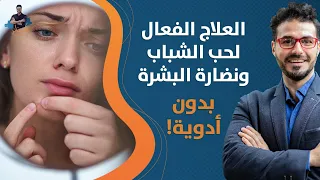 حب الشباب ونضارة البشرة خطوات بسيطة وسهله لتحصل علي بشرة ناعمة بدون دواء 