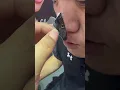Blackheads Removal Nose Pore Strip