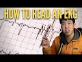 How To Read An EKG In 2023 High Yield