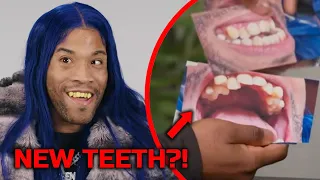 CRAZY Shamar Teeth FIXED in 24 Hours