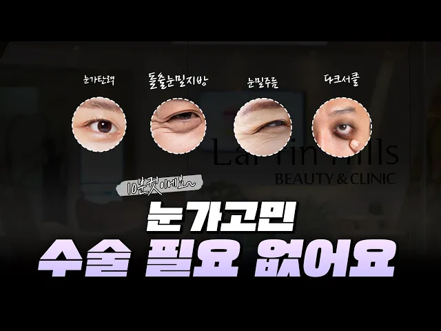 눈가고민, 아직도 수술 하시나요?