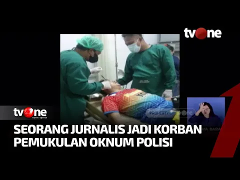 Jurnalis Metro TV Jadi Korban Pemukulan