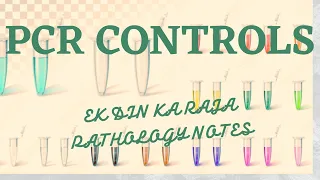 controls control
