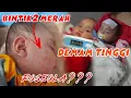 Lagu Cara Mengatasi Demam Tinggi disertai Bintik Merah pada Bayi | Waspada Ruam Merah pada Bayi