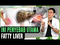Lagu Ini Penyebab \u0026 Gejala Perlemakan Hati (Fatty Liver)