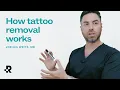 How Tattoo Removal Works