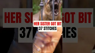 German Shepherd Mauled Her Owner's Sister