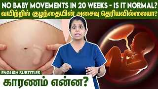 Download No baby movements in 20 weeks - Is it normal | வயிற்றில் குழந்தையின் அசைவு தெரியவில்லையா  MP3