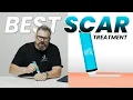 Download Lagu Say Goodbye to Scars: Best Scar Treatment Revealed 😮 #scars #scartreatment