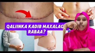 Qaliinka Kadib Maxalaga Rabaa Ina Sameysid Daryeelka Hooyoda Dr Maria 