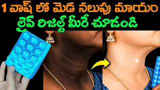 ఈ ఒక్క టాబ్లెట్ చాలు|ఎంత మొండి మెడ నలుపు అయినా 10 నిమిషాల్లో మాయం అవుతుంది|Live Result 