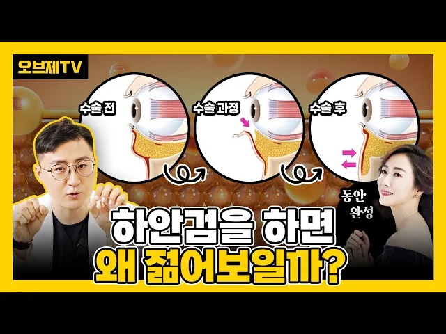 하안검이 젊어보이는 특별한 이유가 있다?! 눈구조부터 수술 방향까지 알차게 알아보는 시간! 오브제 성형외과 김현조 원장님