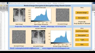 Medical Image Encryption Using Chaotic System Matlab Project With Source Code