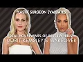 RHOBH Dorit Kemsley s Makeover Nose Job Fillers Just Makeup