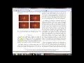 Matlab code for Segmentation of Blood Vessels and Optic Disc in Retinal Images