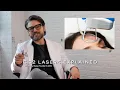 CO2 Laser Explained by a Dermatologist