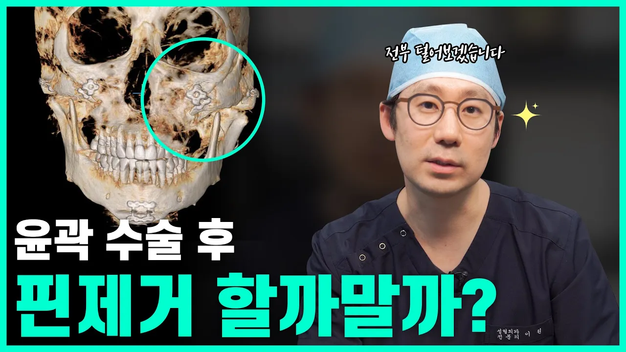 윤곽수술 후 핀제거 할까? 말까?