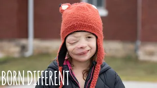 Brave 10-Year-Old Battles Rare Facial Tumour | BORN DIFFERENT