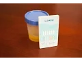 How to Perform a Urine Drug Test
