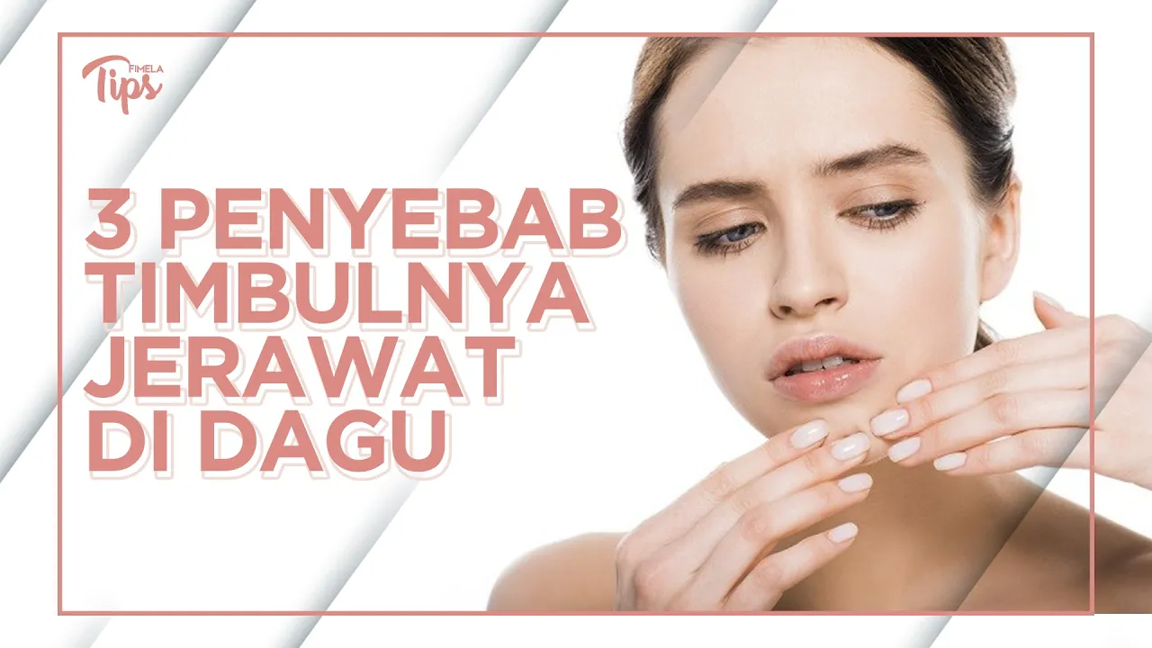 Jerawat Mendem / Batu Akibat Komedo? Ini Skincare & Cara Mengilangkan dari Dokter Kulit | Stylo.ID