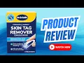 Honest Review of This Skin Tag Remover Kit
