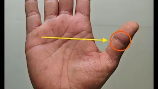 अंगूठे पर ऐसा यव का चिन्ह है तो यकीन मानिये अति भाग्यशाली हैं आप - संपर्क करें +917009126730