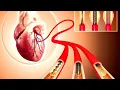 CPT codes for Percutaneous transluminal - simplify medical coding