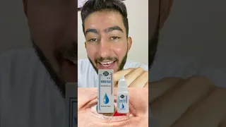 ما هو سبب احمرار العين فجأة  كيف أزيل احمرار العين بسرعة  دندنها