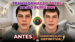 A MELHOR HARMONIZAÇÃO FACIAL MASCULINA! - Daily Vlog com Dr Herlom Vilela