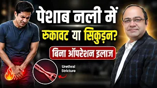 पेशाब रुक-रुक कर आता है? | पेशाब की धार कमजोर है? | Urethral Stricture का बिना ऑपरेशन इलाज?