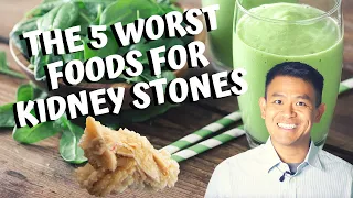 Download The 5 Worst Foods for Calcium Oxalate Kidney Stones | How to Prevent Getting Kidney Stones (2020) MP3