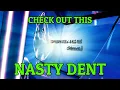 Download Lagu Dent repair using GLEXO cold glue and PDR technique | PAINTLESS DENT REPAIR