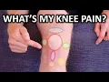 Download Lagu Why Your Knee Hurts. Knee Pain Types By Location \u0026 Description.