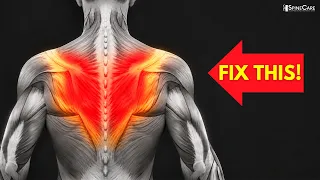 30 SECOND FIX: Instant Upper Back Pain Relief
