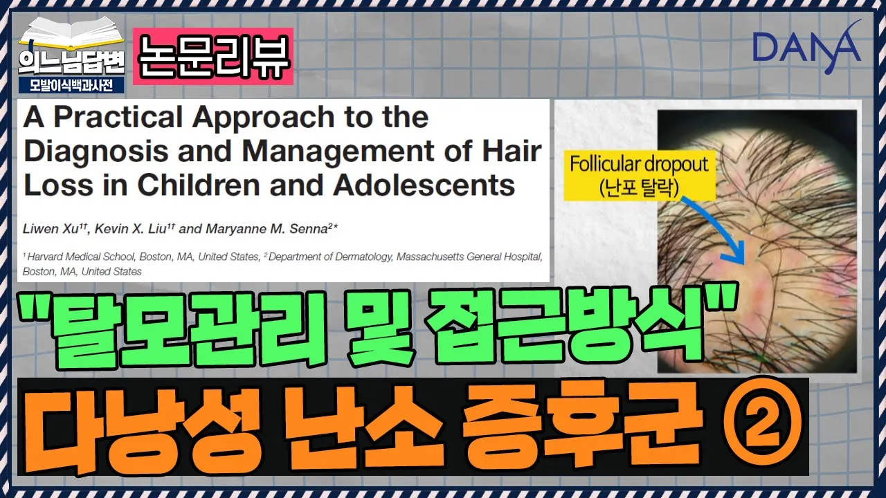 의느님답변📂다낭성 난소 증후군(PCOS)과 여성탈모의 연관성ㅣ다낭성 난소 증후군②ㅣ다나성형외과(DANA)ㅣ모발이식ㅣ헤어라인교정ㅣ두피문신ㅣ탈모치료
