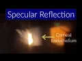 Specular Reflection - Slit Lamp Techniques