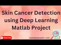 Skin Cancer Detection using Deep Learning Matlab Project