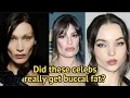 IS THIS WHAT BUCCAL FAT REMOVAL DOES