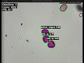 Pollen Detection with OpenFlexure Microscope and YOLO11n AI-Powered Microscopy Sneak