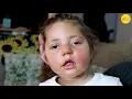 A Toddler with a Severe Brain Injury And Her Loving Family
