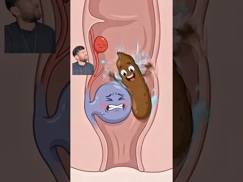 Sitting on the toilet scrolling on your phone for extended periods of time = haemorrhoids.