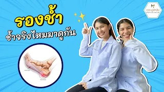 อาการของรองช้ำมีลักษณะอย่างไร