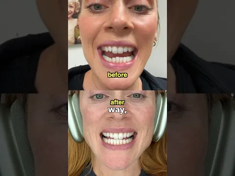 My Biggest Transformation Yet...