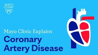 Download Mayo Clinic Explains Coronary Artery Disease MP3