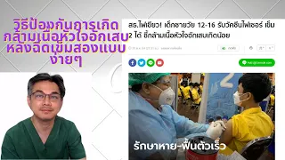 การฉีดวัคซีนไฟเซอร์เข็มที่ 2 อาจทำให้เกิดภาวะกล้ามเนื้อหัวใจอักเสบได้หรือไม่ และมีวิธีลดความเสี่ยงอย่างไร