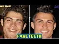 30 Celebrities With Fake Teeth 2018