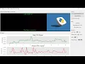 Real-Time Vital Signs Monitor using Python OpenCV Heart Rate SpO2 Breathing Rate GUI App